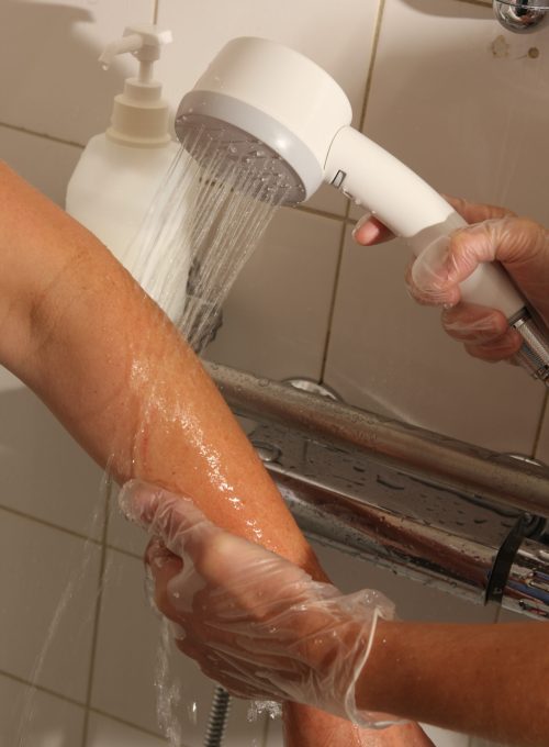 Filtroiantilegionella terminali in uso presso un ospedale